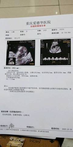 好(hǎo)奇問(wèn)一(yī)下(xià)是(shì)男(nán)寶還(hái)是(shì)女(nǚ)寶?